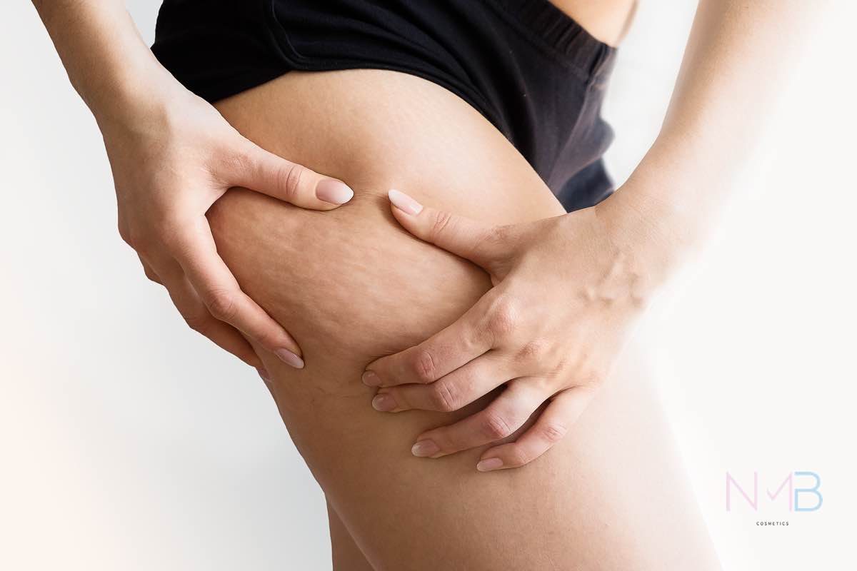 Centro de Estética Integral - Presoterapia: En abdomen y Piernas. ⠀⠀⠀⠀⠀  ¿Que beneficios tiene la Presoterapia? 👇:. ⠀⠀⠀⠀⠀ ✓ Mejora el aspecto de la  piel y combate la celulitis. ✓ Combate la